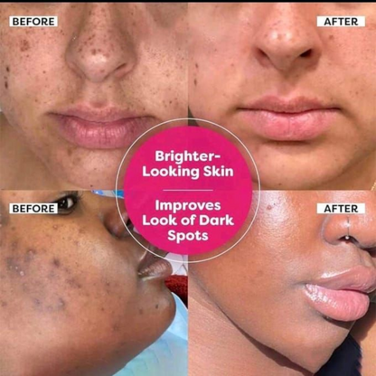 Axis-y Dark Spot Correcting Glow Serum