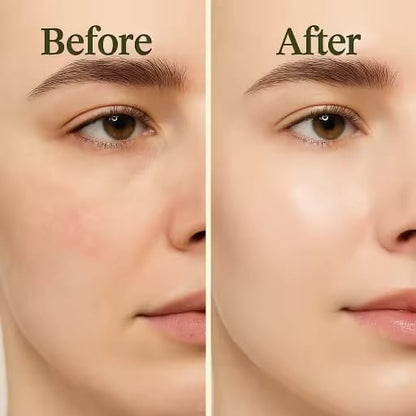 Artichoke Intensive Barrier Ampoule