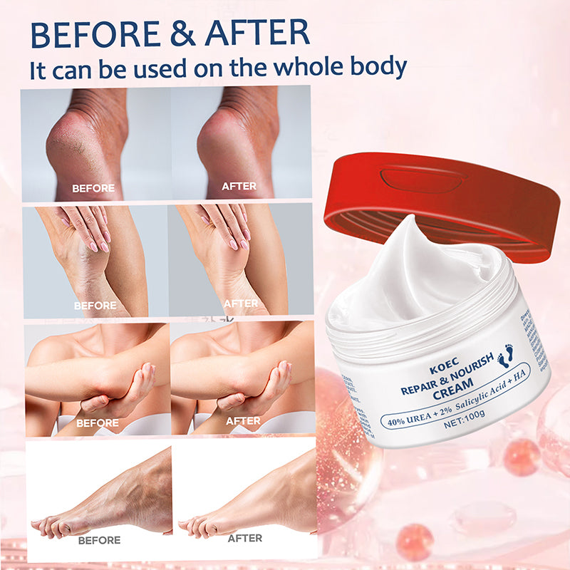 KOEC 40% Repair Noruish Urea Cream