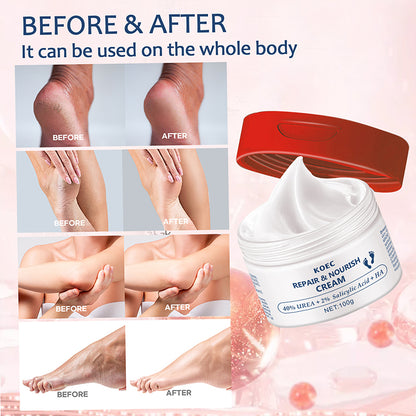 KOEC 40% Repair Noruish Urea Cream