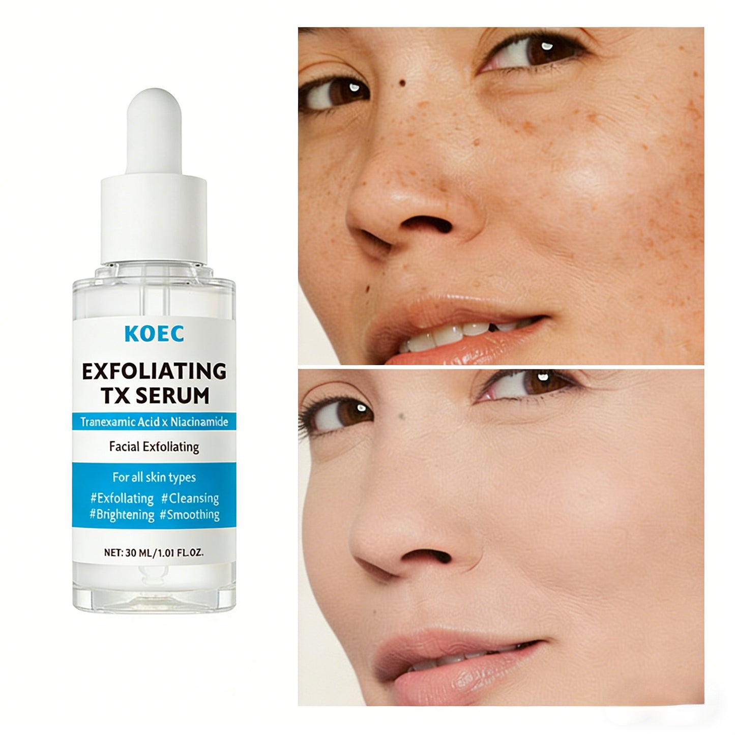 KOEC Exfoliating TX Serum