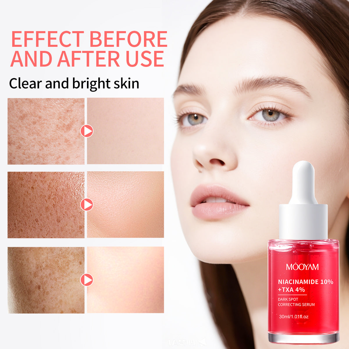 MOOYAM  Niacinamide 10% TXA 4% Dark Sport Correcting Serum