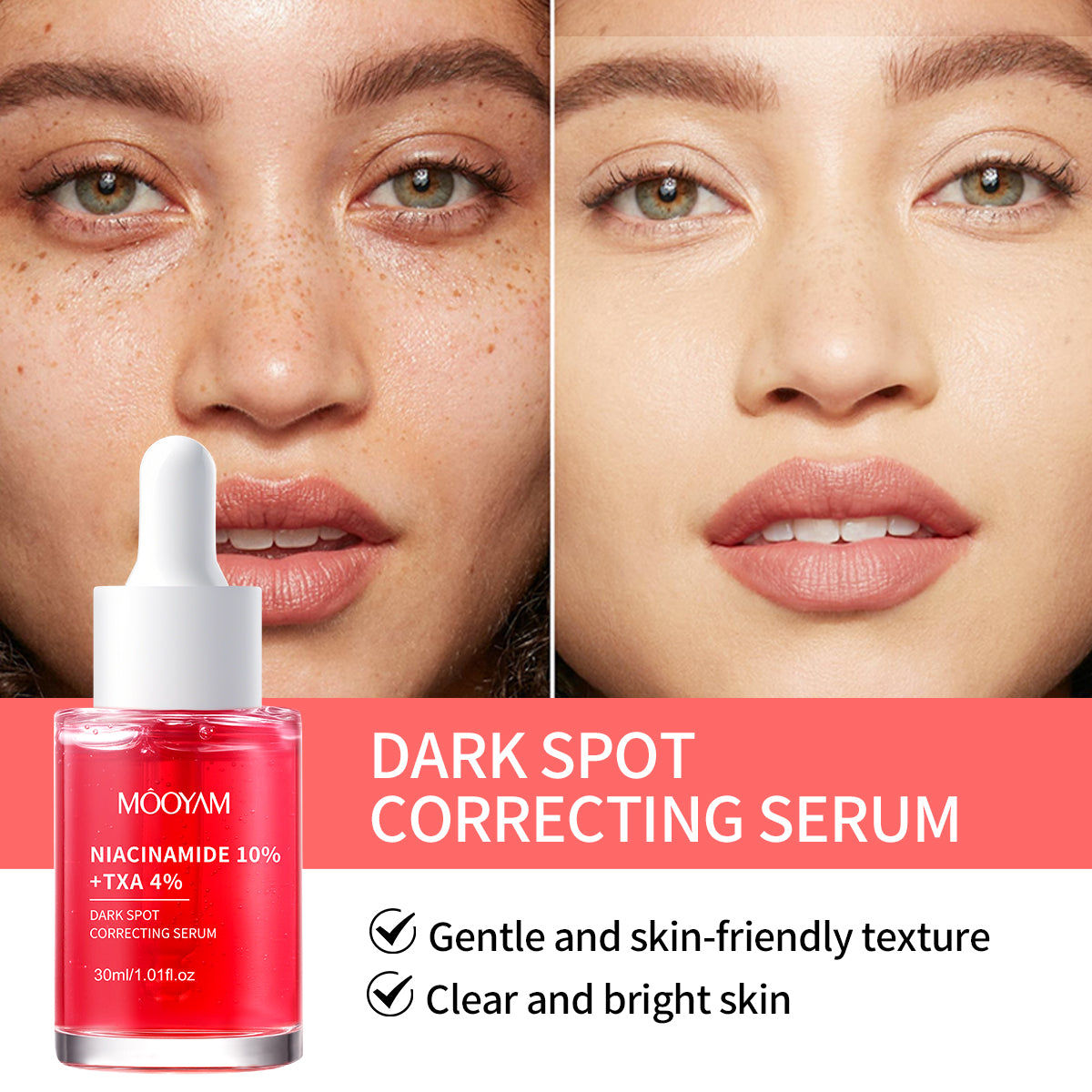 MOOYAM  Niacinamide 10% TXA 4% Dark Sport Correcting Serum