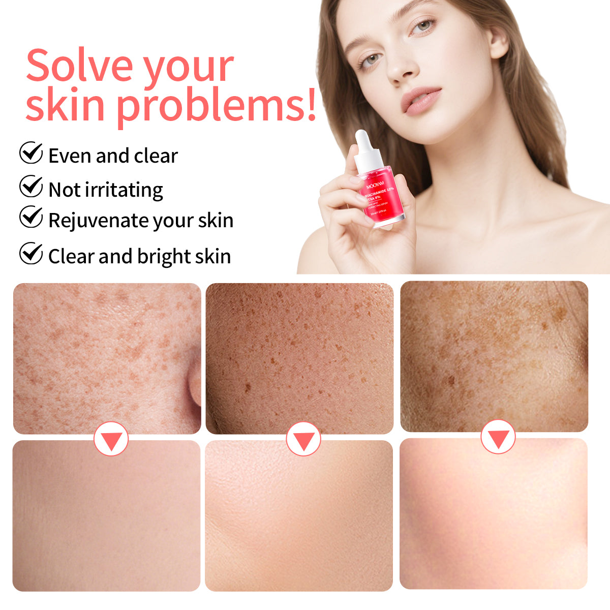 MOOYAM  Niacinamide 10% TXA 4% Dark Sport Correcting Serum
