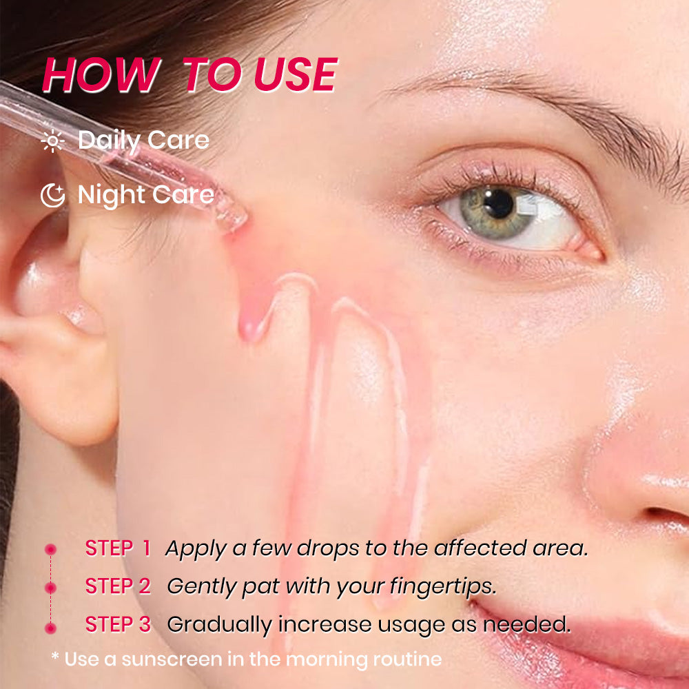 KOEC Niacinamide 10% + TXA 4 Serum Facial Serum