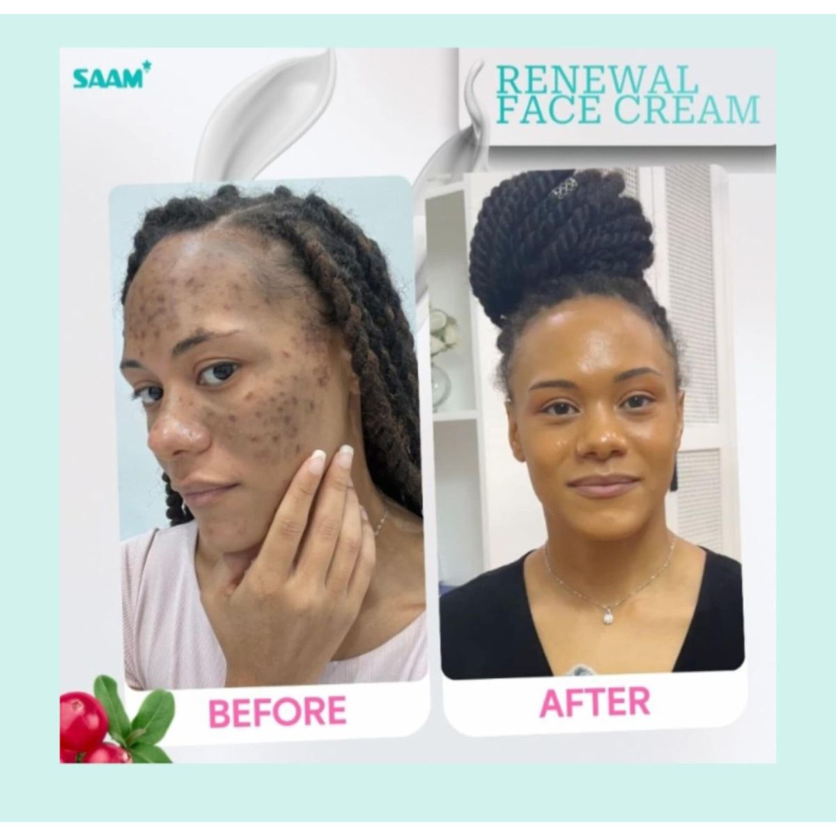 SAAM Renewal Face Cream for Melasma, Pigmentation And Dark Spots
