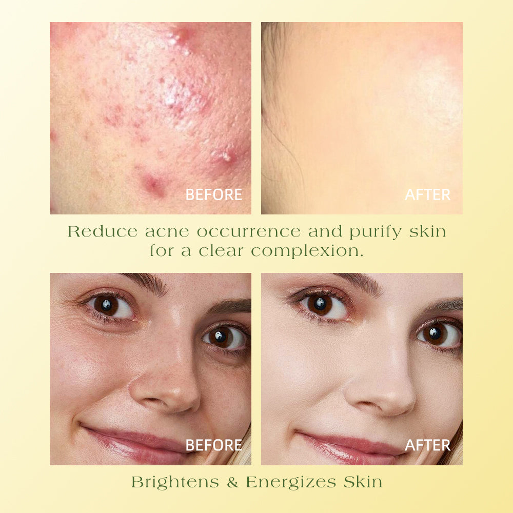 TWG kojic acid &turmeric cleansing pad